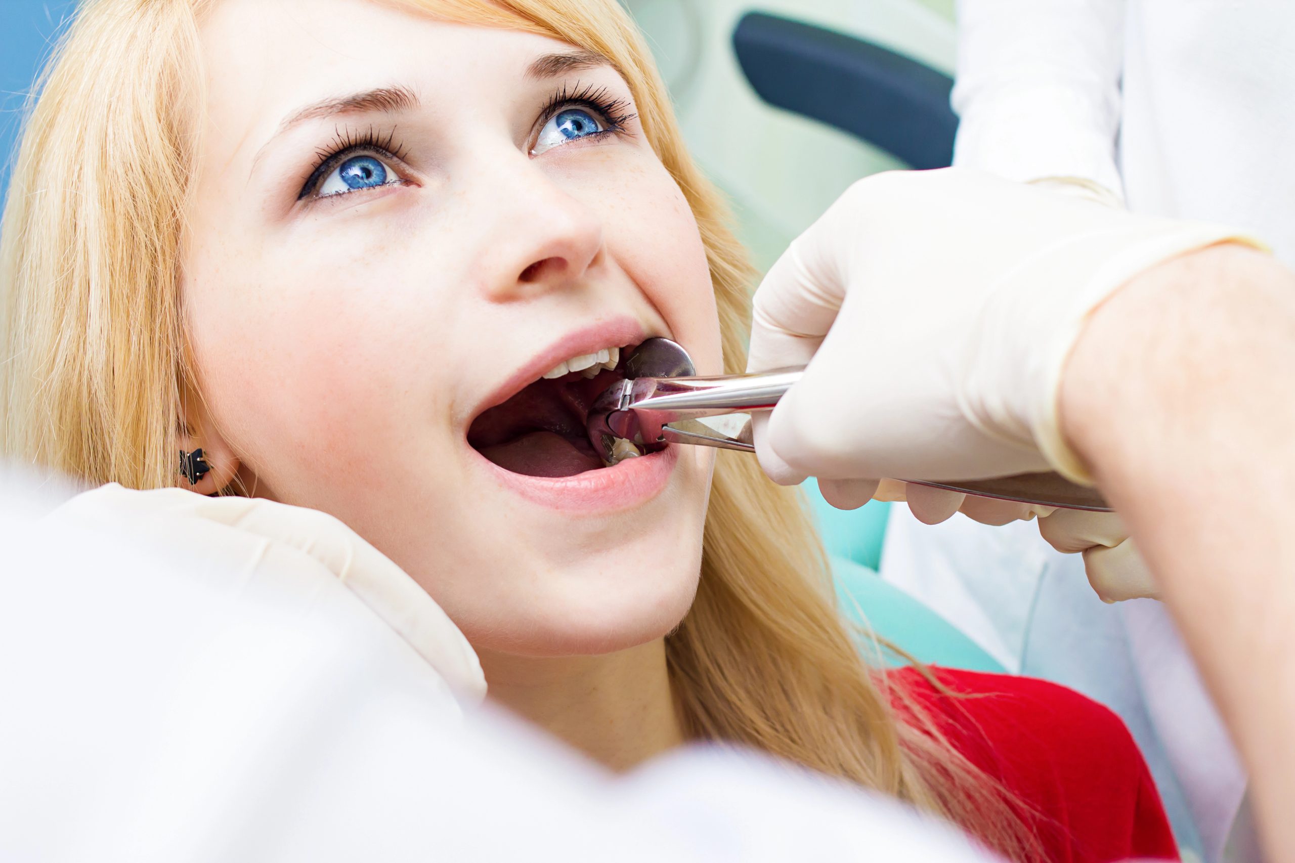 Tooth Extractions Tooth Extractions